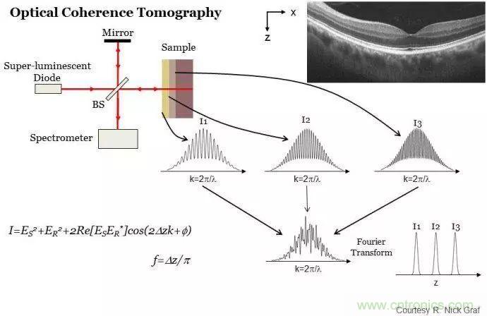 解讀光學(xué)相干層析成像技術(shù)